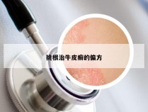 挑根治牛皮癣的偏方