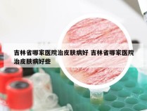 吉林省哪家医院治皮肤病好 吉林省哪家医院治皮肤病好些