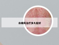 白癜风治疗多久能好