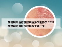 生物制剂治疗皮肤病后多久能怀孕 2021生物制剂治疗皮肤病多少钱一支