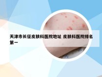 天津市长征皮肤科医院地址 皮肤科医院排名第一