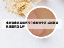 成都银康银屑病医院在成都哪个区 成都银康银屑医院怎么样
