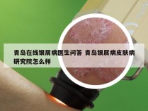 青岛在线银屑病医生问答 青岛银屑病皮肤病研究院怎么样