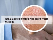 沉香吊坠能引发牛皮癣发作吗 带沉香过敏是怎么回事