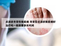 点滴状寻常性银屑病 寻常型点滴状银屑病好治疗吗一般需要多长时间