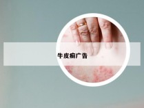 牛皮癣广告