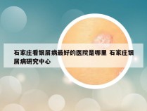 石家庄看银屑病最好的医院是哪里 石家庄银屑病研究中心