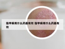 指甲癣用什么药最有效 指甲癣用什么药最有效