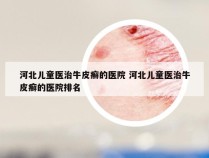 河北儿童医治牛皮癣的医院 河北儿童医治牛皮癣的医院排名