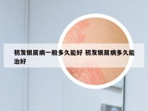 初发银屑病一般多久能好 初发银屑病多久能治好