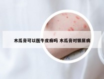 木瓜膏可以医牛皮癣吗 木瓜膏对银屑病
