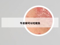 牛皮癣可以吃鲍鱼