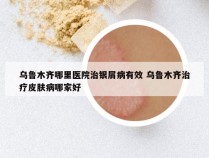 乌鲁木齐哪里医院治银屑病有效 乌鲁木齐治疗皮肤病哪家好