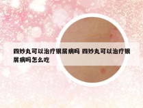 四妙丸可以治疗银屑病吗 四妙丸可以治疗银屑病吗怎么吃