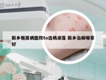 新乡银屑病医院to选杨淑莲 新乡治癣哪家好