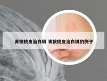 青核桃皮治白斑 青核桃皮治白斑的例子