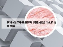 阿维a治疗牛皮癣好吗 阿维a配合什么药治什皮癣