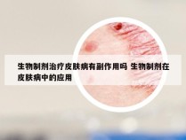 生物制剂治疗皮肤病有副作用吗 生物制剂在皮肤病中的应用