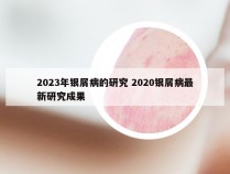 2023年银屑病的研究 2020银屑病最新研究成果