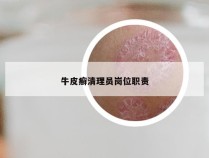 牛皮癣清理员岗位职责