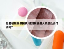 患者被银屑病困扰 碰到银屑病人的患处会传染吗?