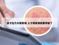 孩子压力大银屑病 儿子银屑病我要抑郁了