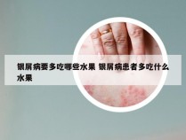 银屑病要多吃哪些水果 银屑病患者多吃什么水果