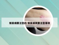 银屑病要注意的 银屑病需要注意事项