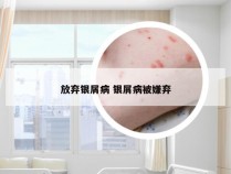 放弃银屑病 银屑病被嫌弃