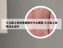 小儿脸上有白斑是缺少什么原因 小儿脸上白斑怎么治疗