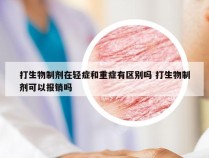 打生物制剂在轻症和重症有区别吗 打生物制剂可以报销吗