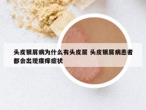 头皮银屑病为什么有头皮屑 头皮银屑病患者都会出现瘙痒症状