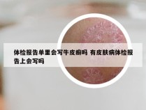 体检报告单里会写牛皮癣吗 有皮肤病体检报告上会写吗