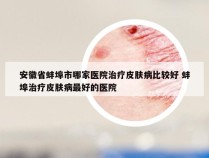 安徽省蚌埠市哪家医院治疗皮肤病比较好 蚌埠治疗皮肤病最好的医院