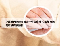 宁波第六医院可以治疗牛皮癣吗 宁波第六医院有没有皮肤科