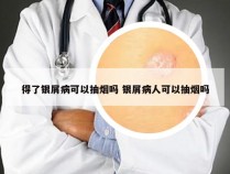 得了银屑病可以抽烟吗 银屑病人可以抽烟吗