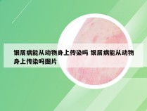 银屑病能从动物身上传染吗 银屑病能从动物身上传染吗图片