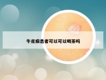 牛皮癣患者可以可以喝茶吗
