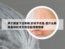 两个膝盖下边有癣,肘关节也是,是什么癣 膝盖和肘关节附近起疙瘩很痒