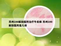 苏州100解放医院治疗牛皮癣 苏州100解放医院是几级