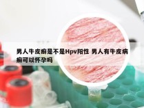 男人牛皮癣是不是Hpv阳性 男人有牛皮病癣可以怀孕吗
