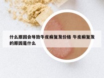 什么原因会导致牛皮癣复发价格 牛皮癣复发的原因是什么