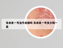生命素一号治牛皮癣吗 生命素一号多少钱一盒