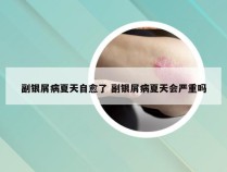 副银屑病夏天自愈了 副银屑病夏天会严重吗