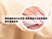 银屑病的涂什么药膏 银屑病涂什么药膏最管用不是激素药