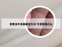 蛋黄治牛皮癣最佳方法 牛蛋黄是什么