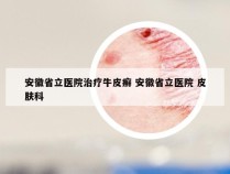 安徽省立医院治疗牛皮癣 安徽省立医院 皮肤科