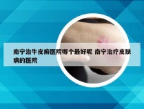 南宁治牛皮癣医院哪个最好呢 南宁治疗皮肤病的医院