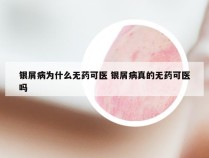 银屑病为什么无药可医 银屑病真的无药可医吗