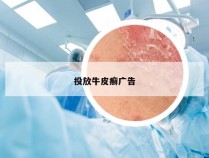 投放牛皮癣广告